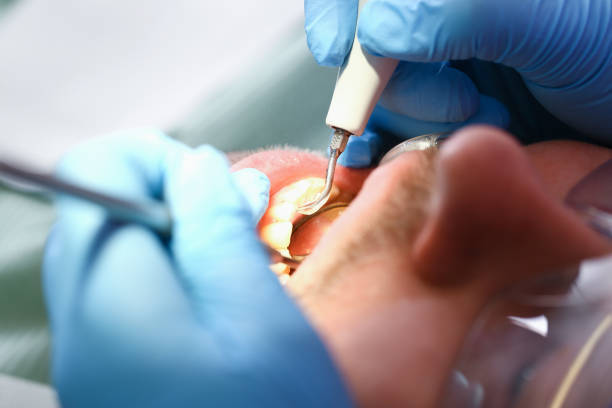 Best Weekend Emergency Dentist in Biltmore Forest, NC