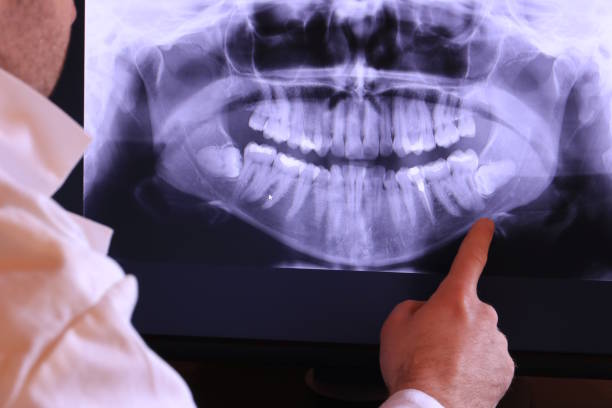 Best Emergency Broken Tooth Repair in Biltmore Forest, NC