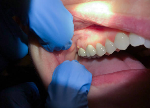 Best Emergency Root Canal Treatment in Biltmore Forest, NC