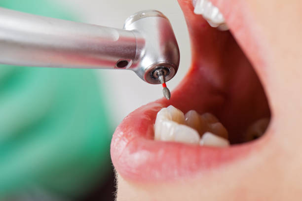 Best After-Hours Emergency Dentist in Biltmore Forest, NC